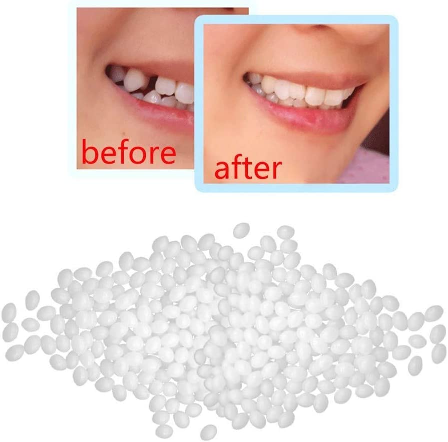 Thermal Fitting Beads (5 uses)