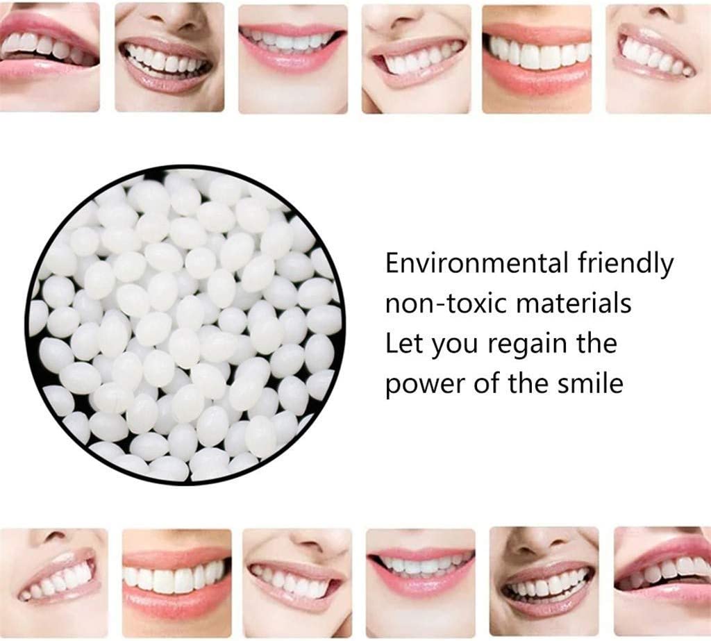 Thermal Fitting Beads (5 uses)