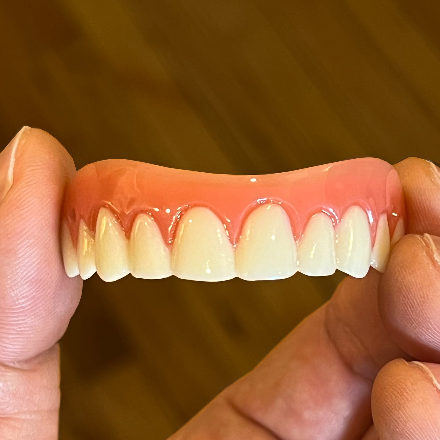 My Instant Veneers™ (Upper Only)